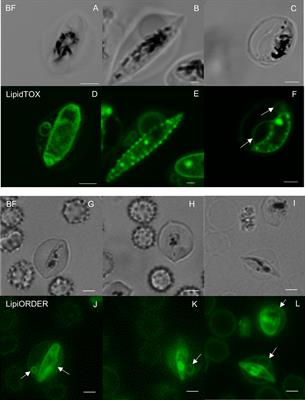 Budding pouches and associated bubbles: 3D visualization of exo-membrane structures in plasmodium falciparum gametocytes